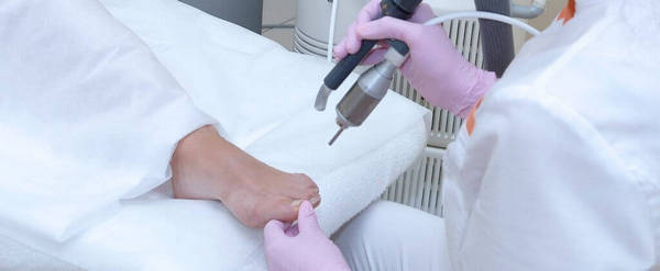 Лечение грибка ногтя лазером