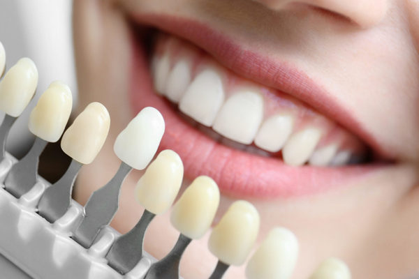Зубные коронки: что важно знать?