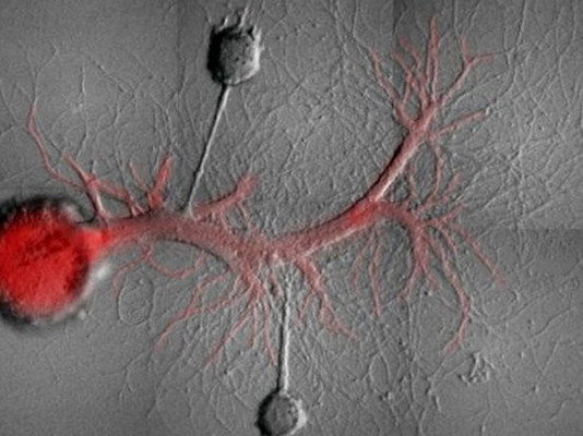 Нервные клетки моллюска, которому стерли воспоминания